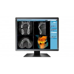MX216-SB